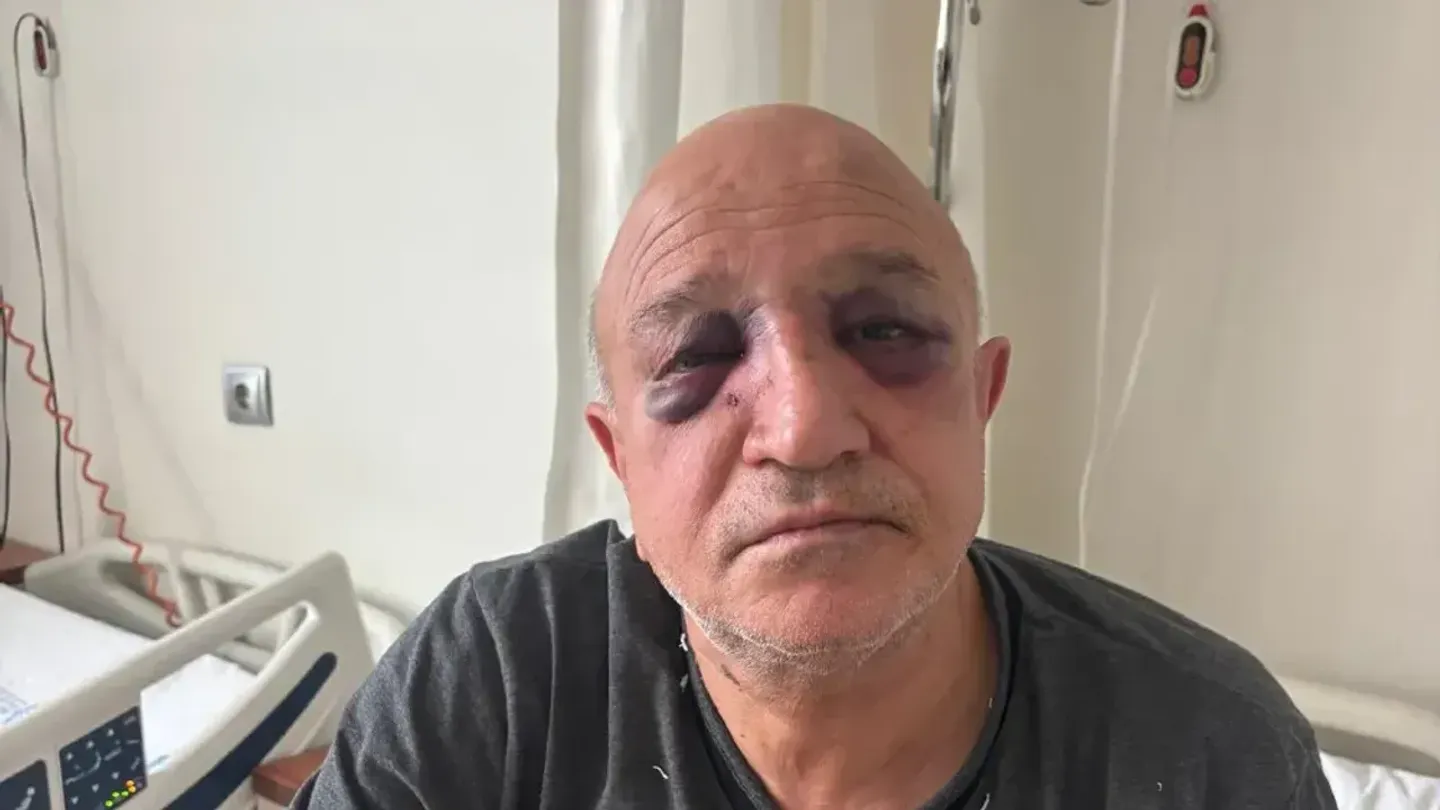 İzmir’de Oda Başkanına Kanlı Saldırı! Bir Şüpheli Tutuklandı, 4 Kişi Aranıyor